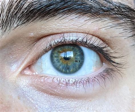 are hazel eyes heterochromia.